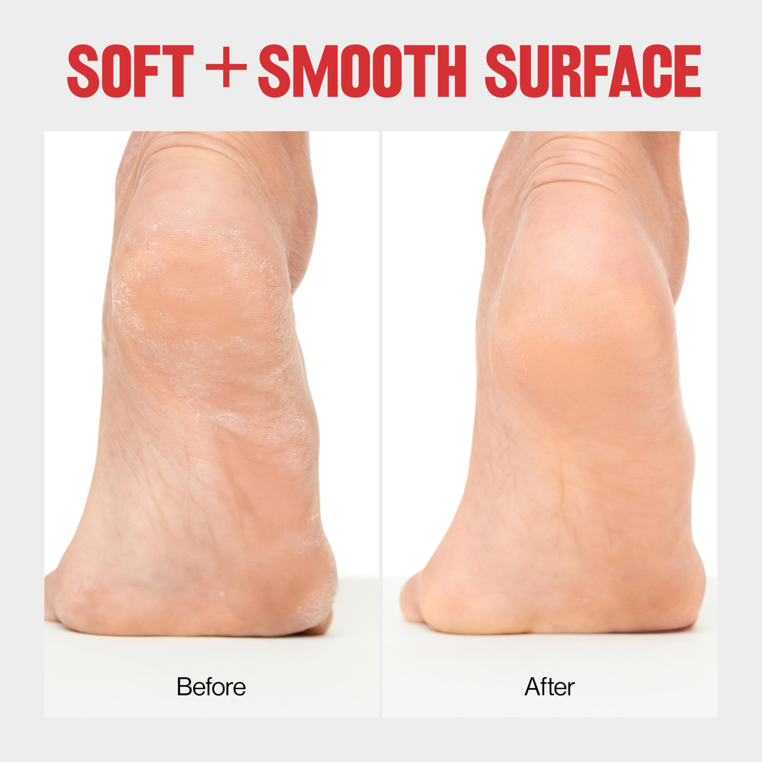Revlon foot care pedicure tool highlighting the dual-function protective cover placed over the micro-blades.