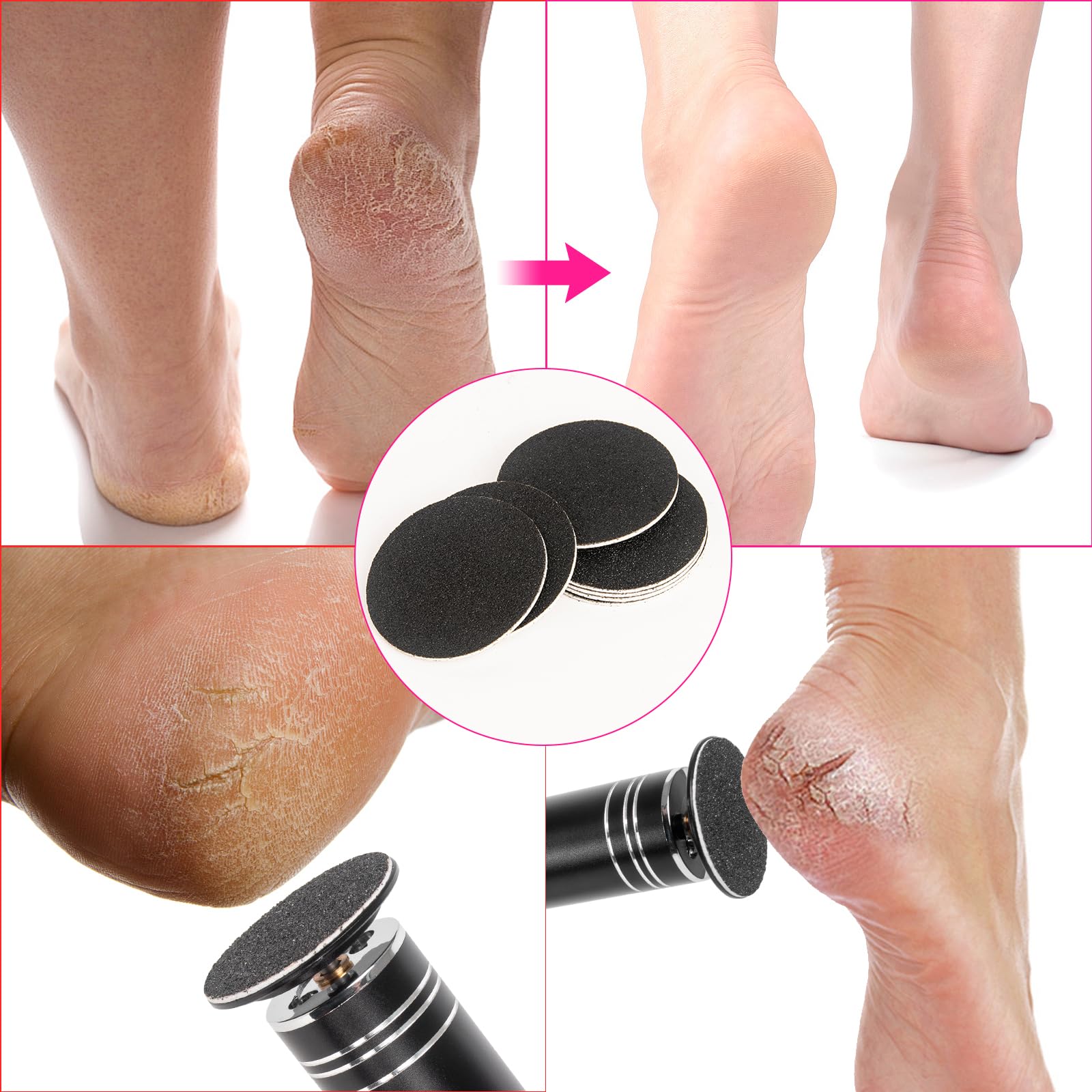 Professional pedicure tool usage with replacement sanding pad