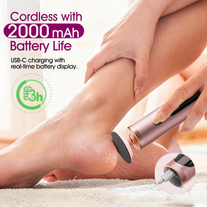 Hand holding Bicboz electric foot file for cracked heels