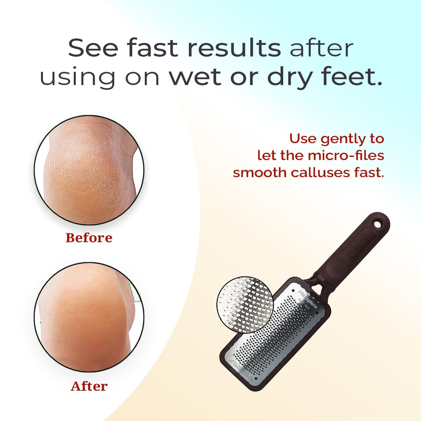 Microplane professional foot scrubber angle view showing lightweight design for cracked heels treatment
