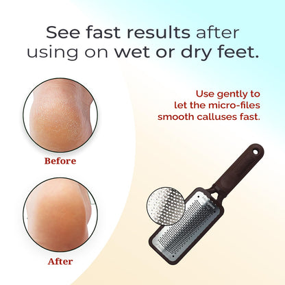 Microplane professional foot scrubber angle view showing lightweight design for cracked heels treatment