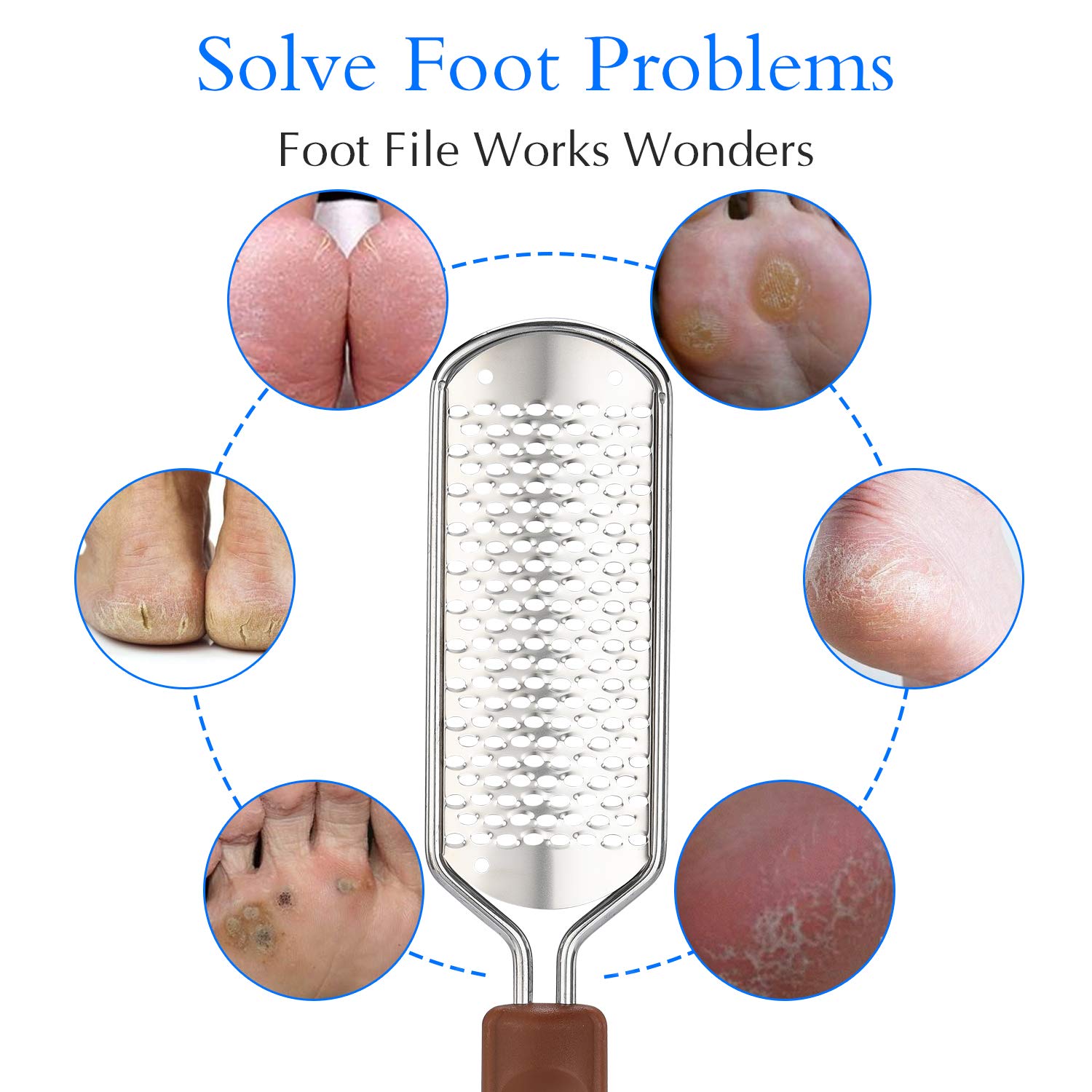 Close up view of the surgical grade stainless steel pedicure rasp pattern for callus removal