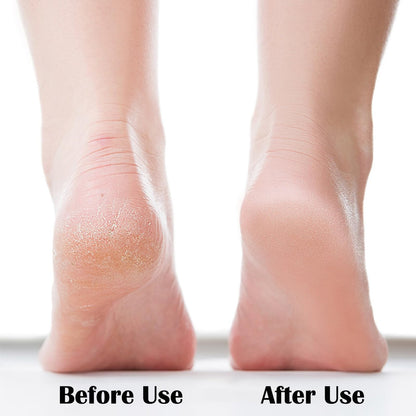 MR LION foot scrubber being used on a dry heel