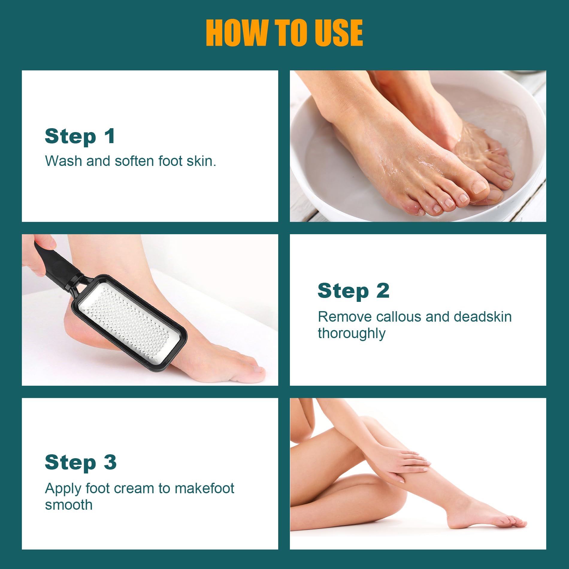 Ergonomic non slip frosted handle of the foot callus remover