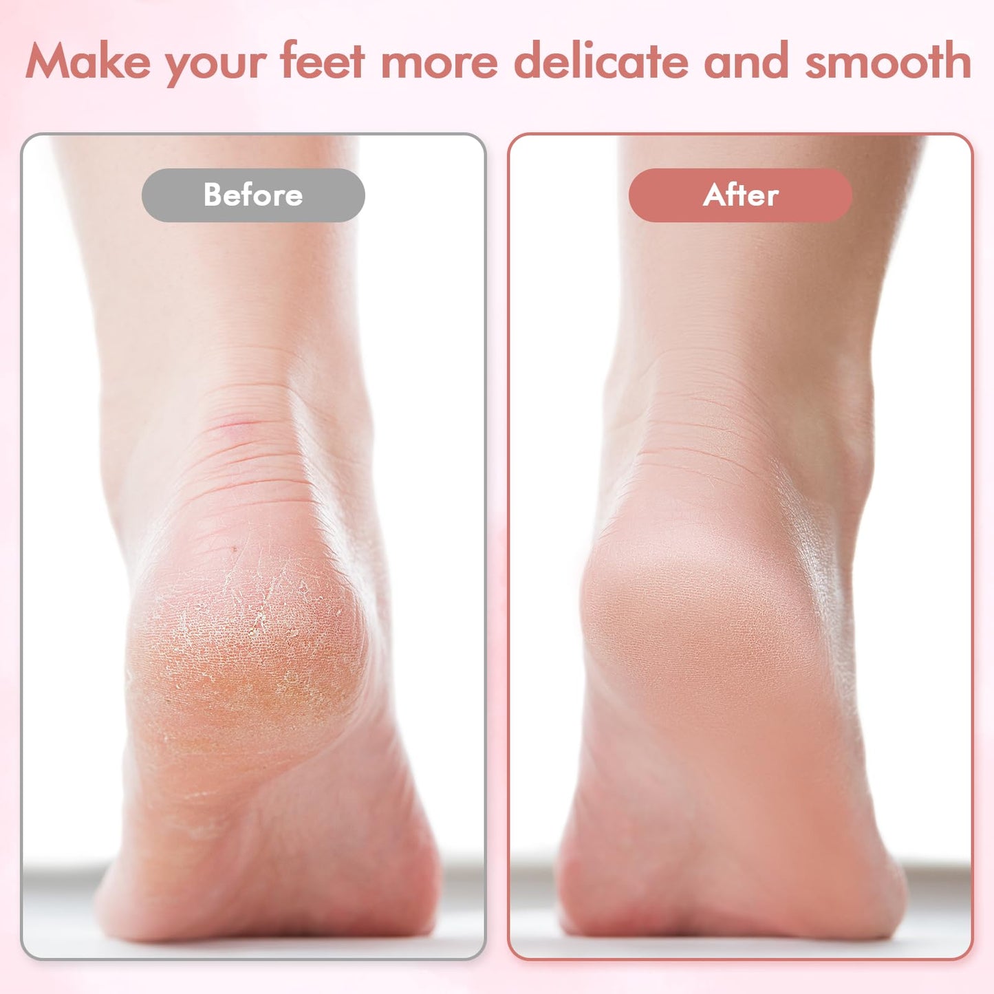 Rose gold and white electric callus remover for dry feet