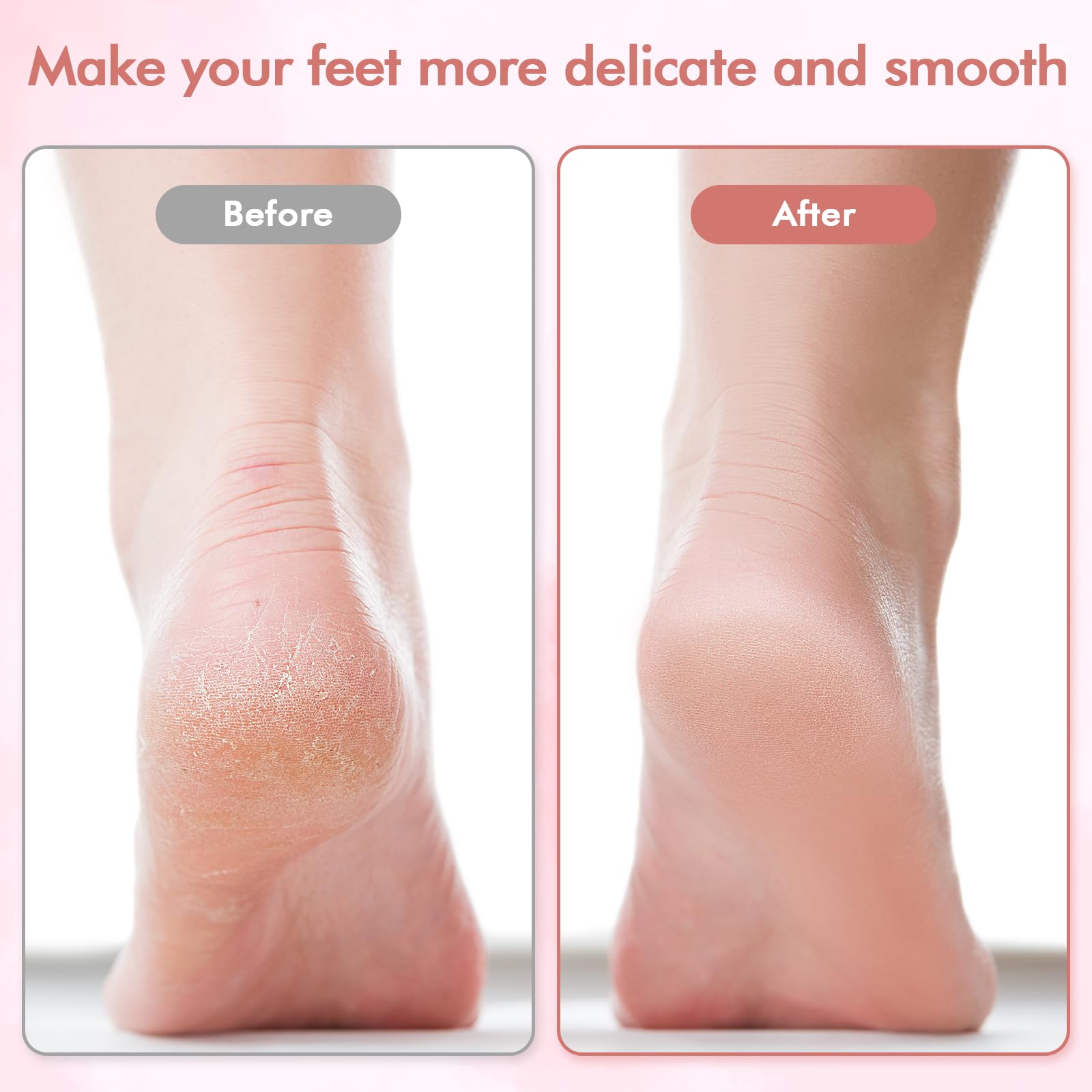 Rose gold and white electric callus remover for dry feet