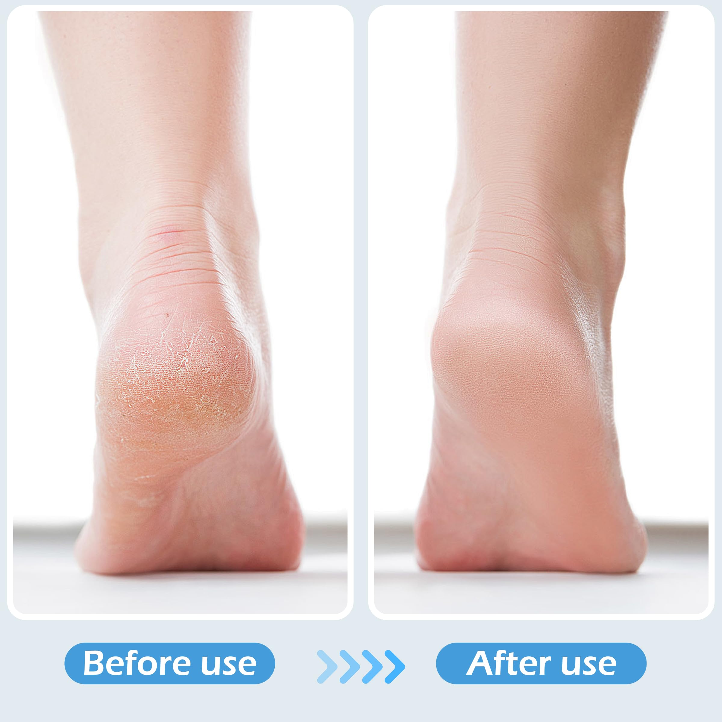 Close up of TaShow 3-piece foot care kit bristles