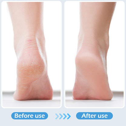 Close up of TaShow 3-piece foot care kit bristles