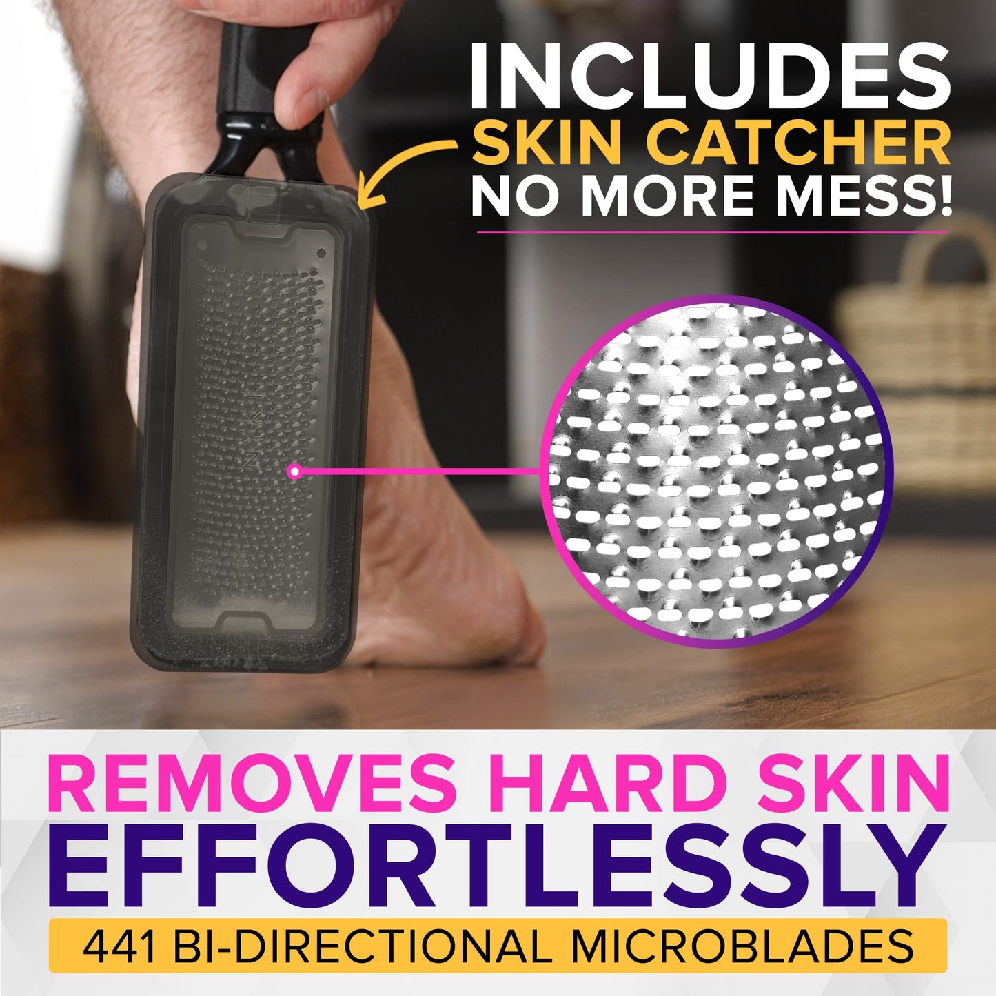 NYK1 XL callus remover showing the skin catcher compartment