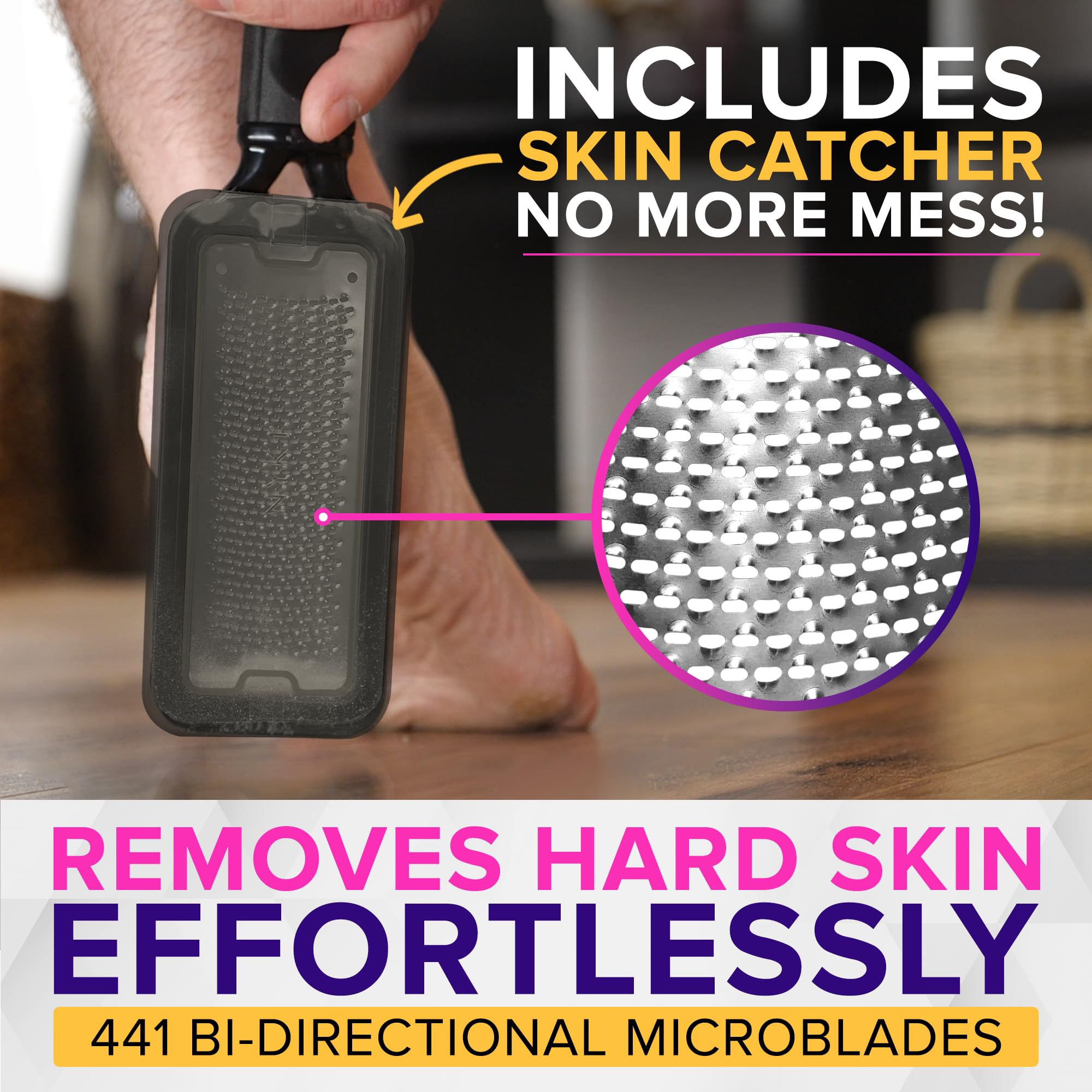 NYK1 XL callus remover showing the skin catcher compartment
