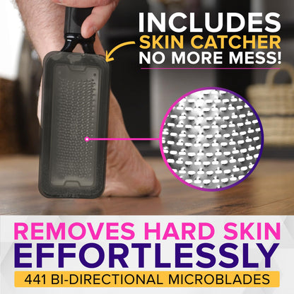NYK1 XL callus remover showing the skin catcher compartment
