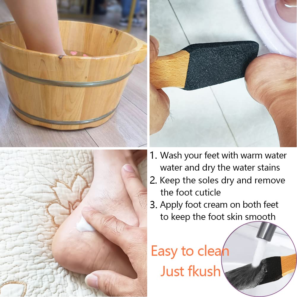 Topmeet foot file used for removing heel calluses