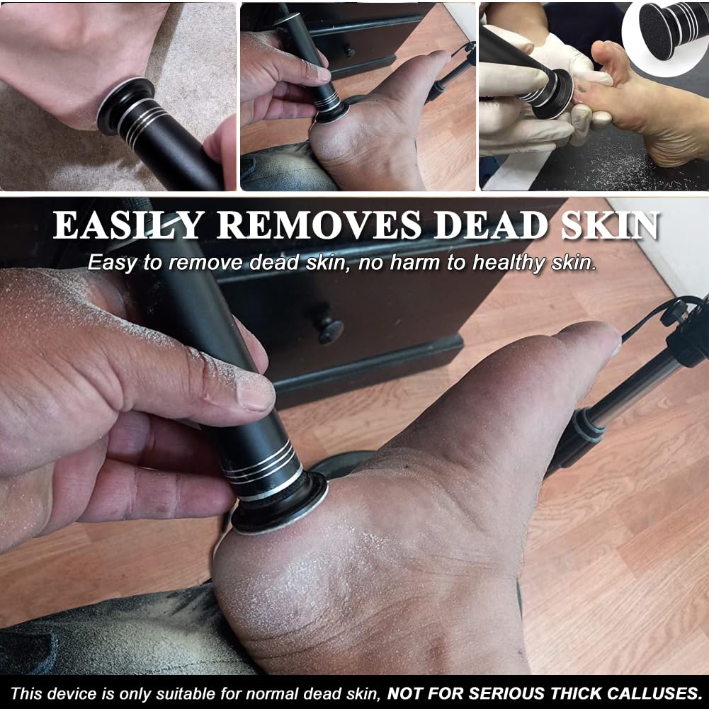 IÂ·BÂ·N G callus remover device front profile view