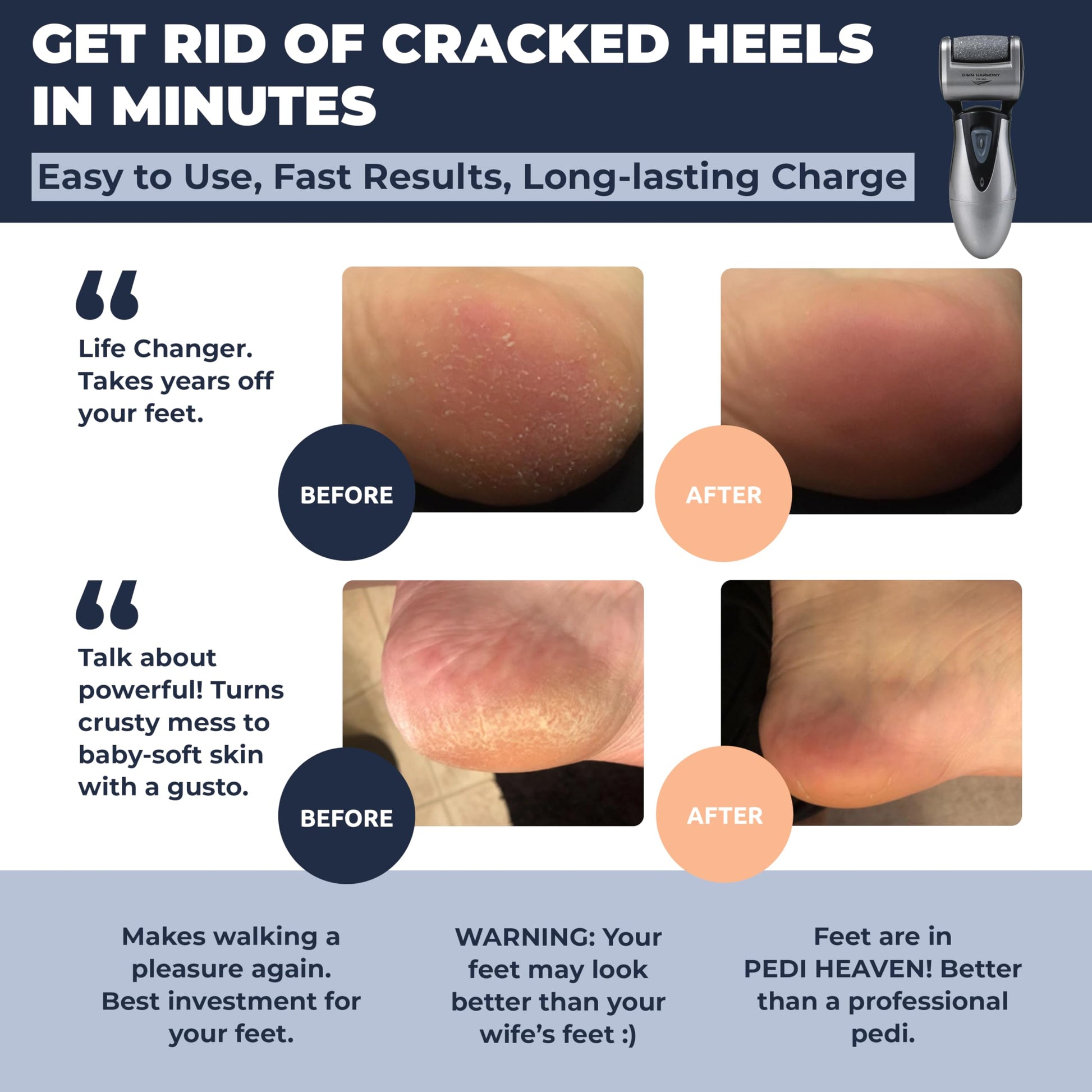 Own Harmony rechargeable pedicure tool with three roller heads