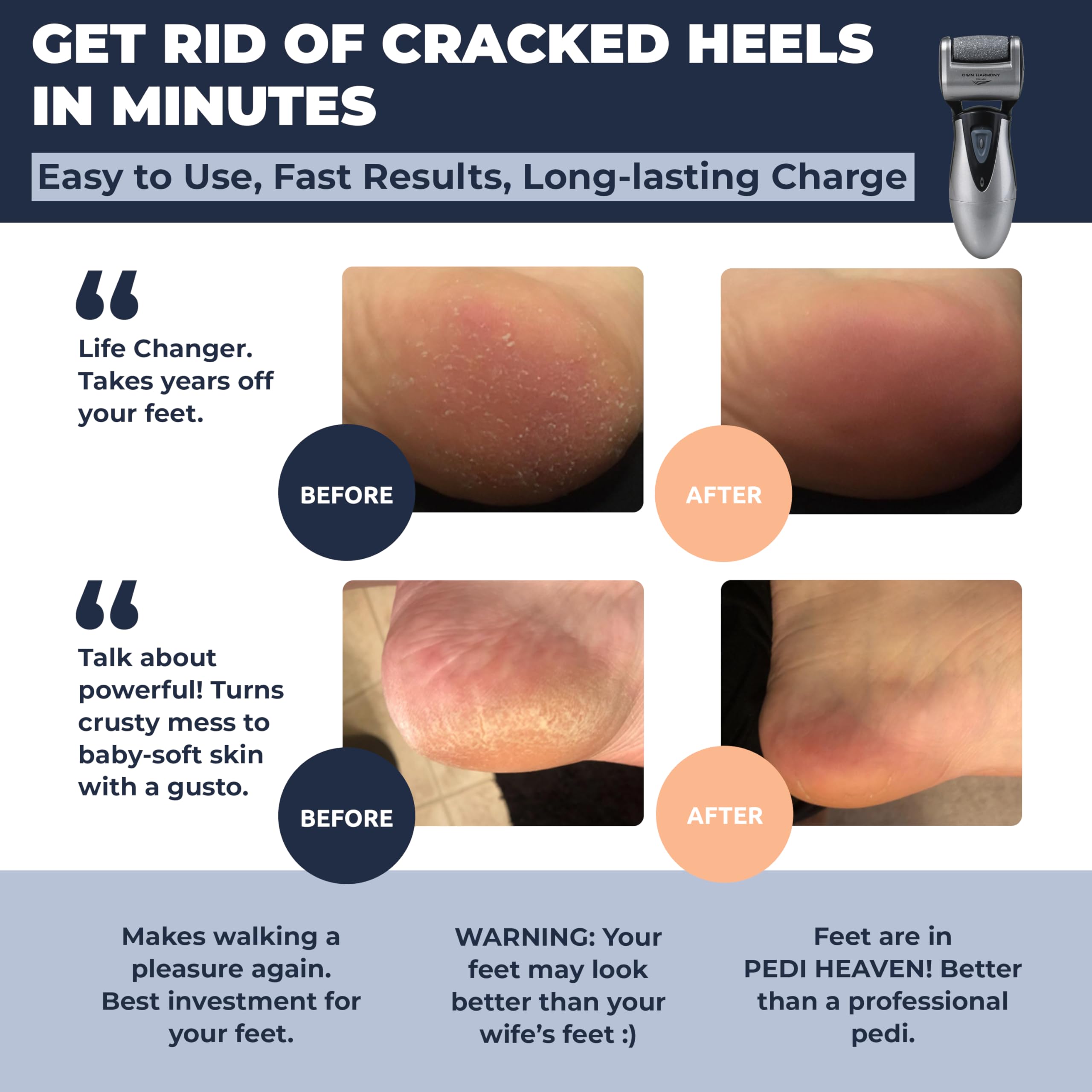 Own Harmony rechargeable pedicure tool with three roller heads