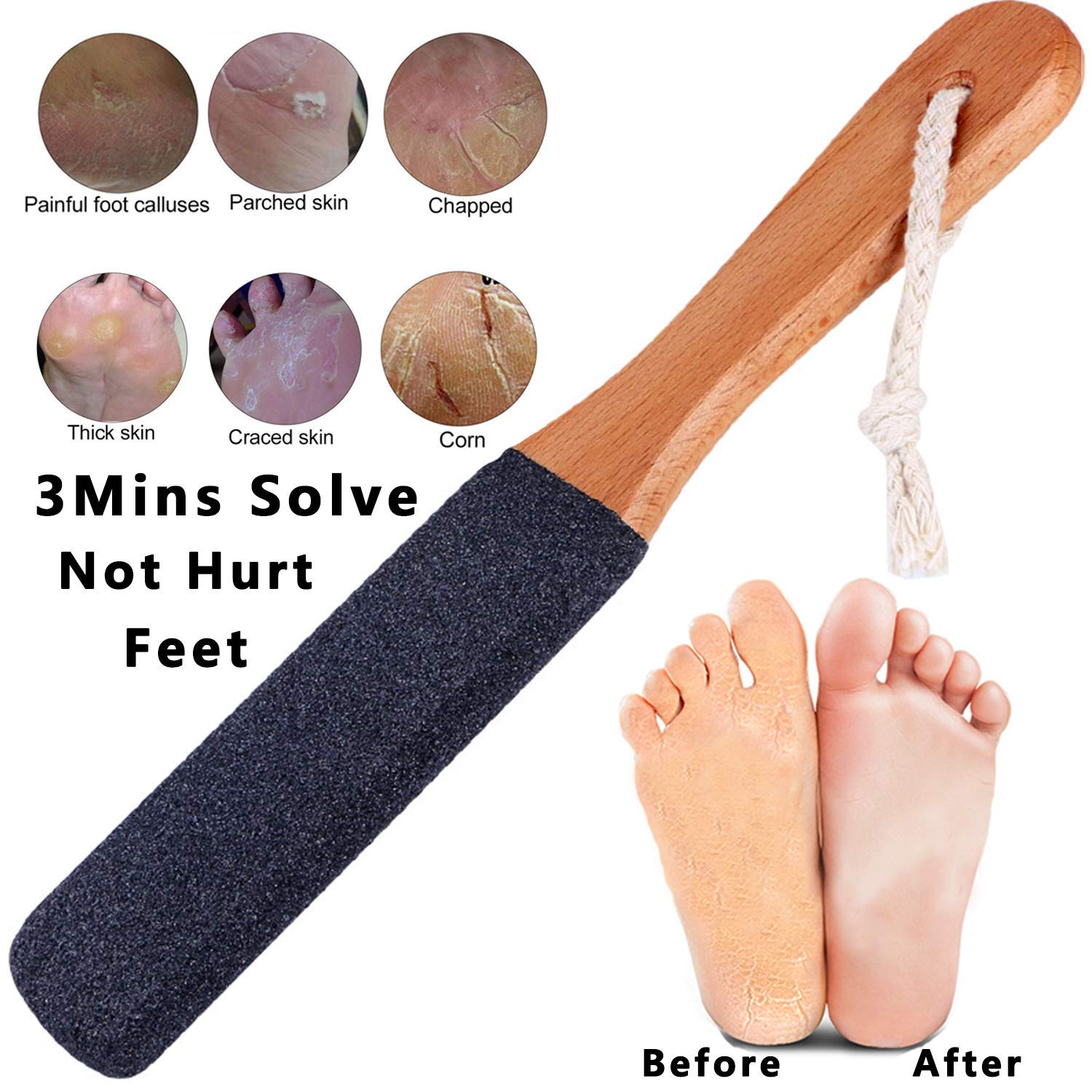 Close up shot of the dual sided Kinepi foot scrubber texture demonstrating the exfoliating corundum stone surface.