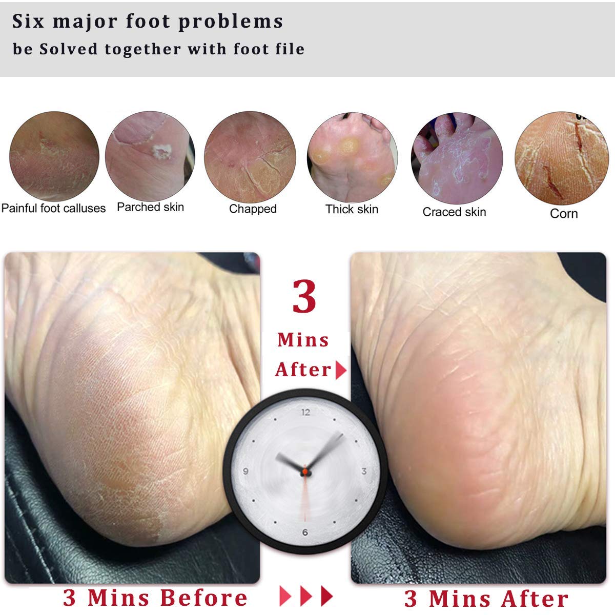 Kinepi manual pedicure rasp being held by the ergonomic non slip wooden handle highlighting the cotton hanging loop.