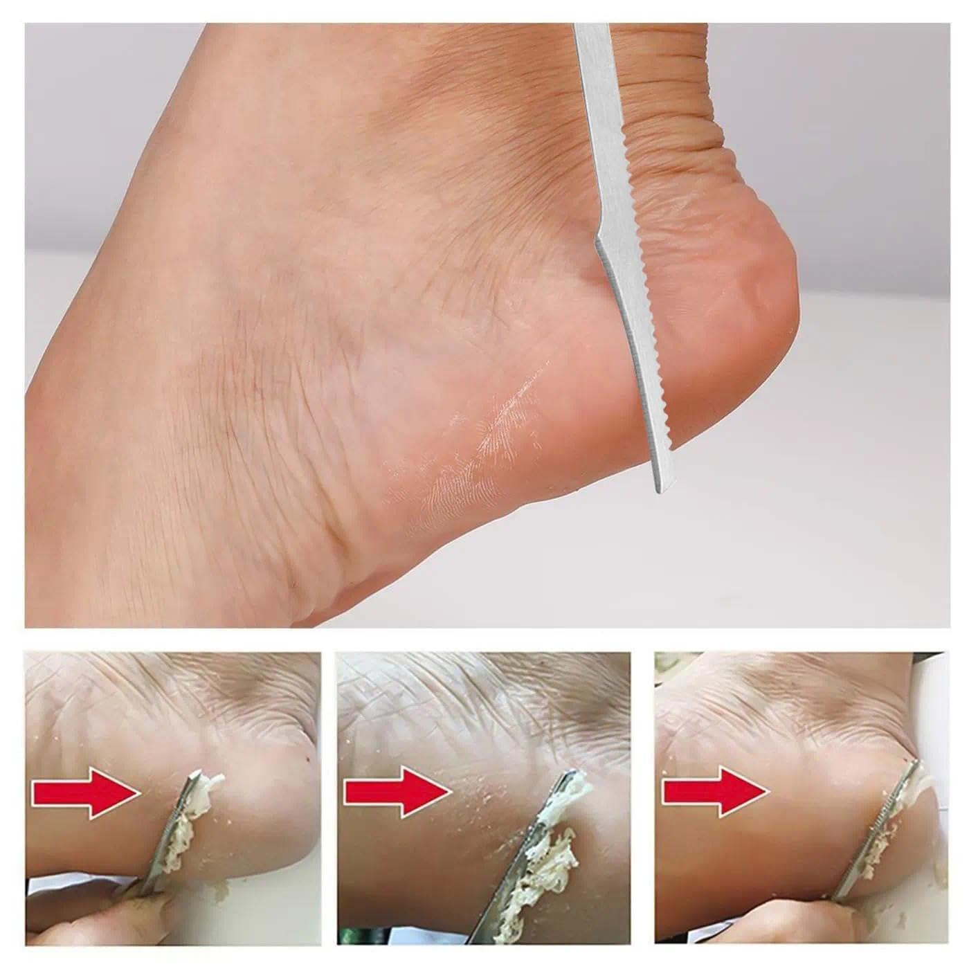 Two stainless steel callus remover tools for feet close up