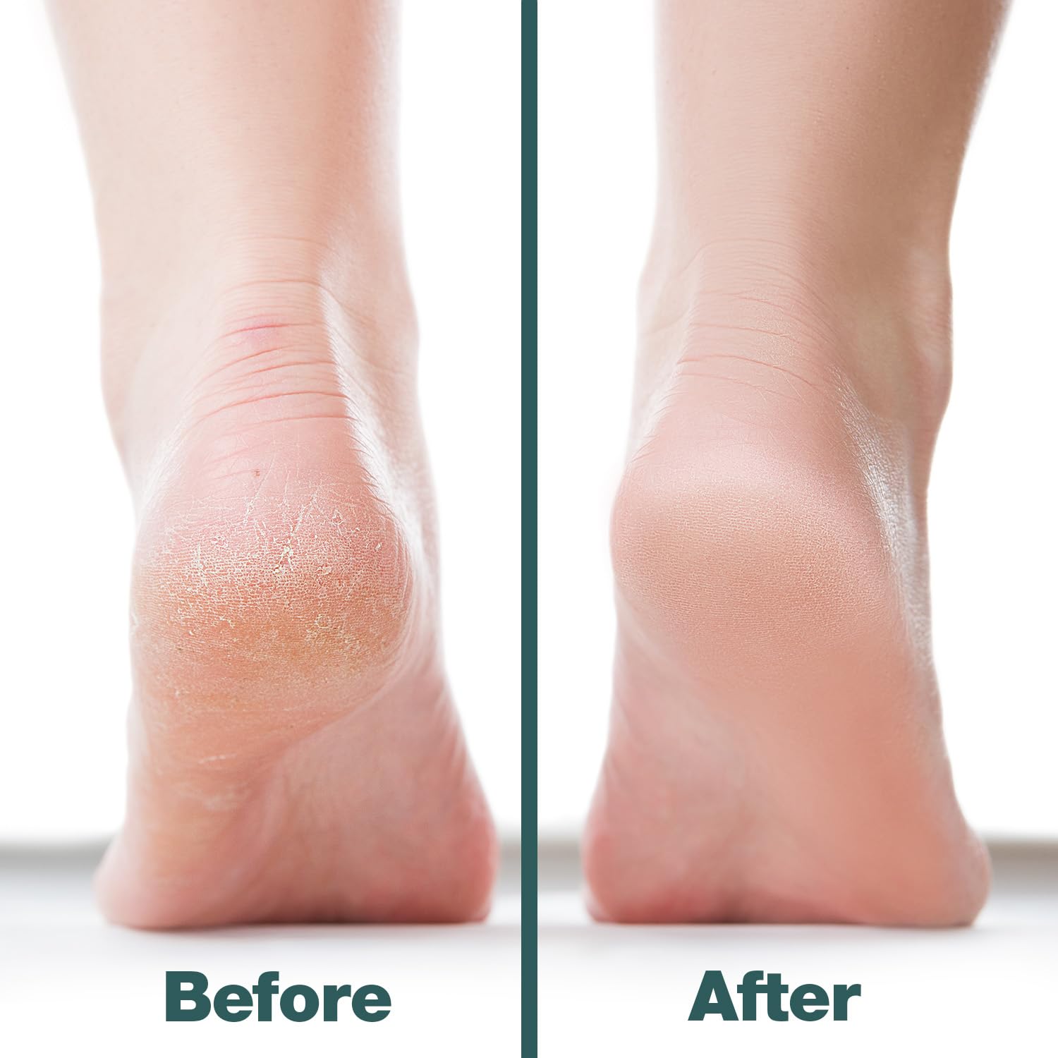 Probelle multidirectional foot care tool showing the full ten inch compact travel profile.