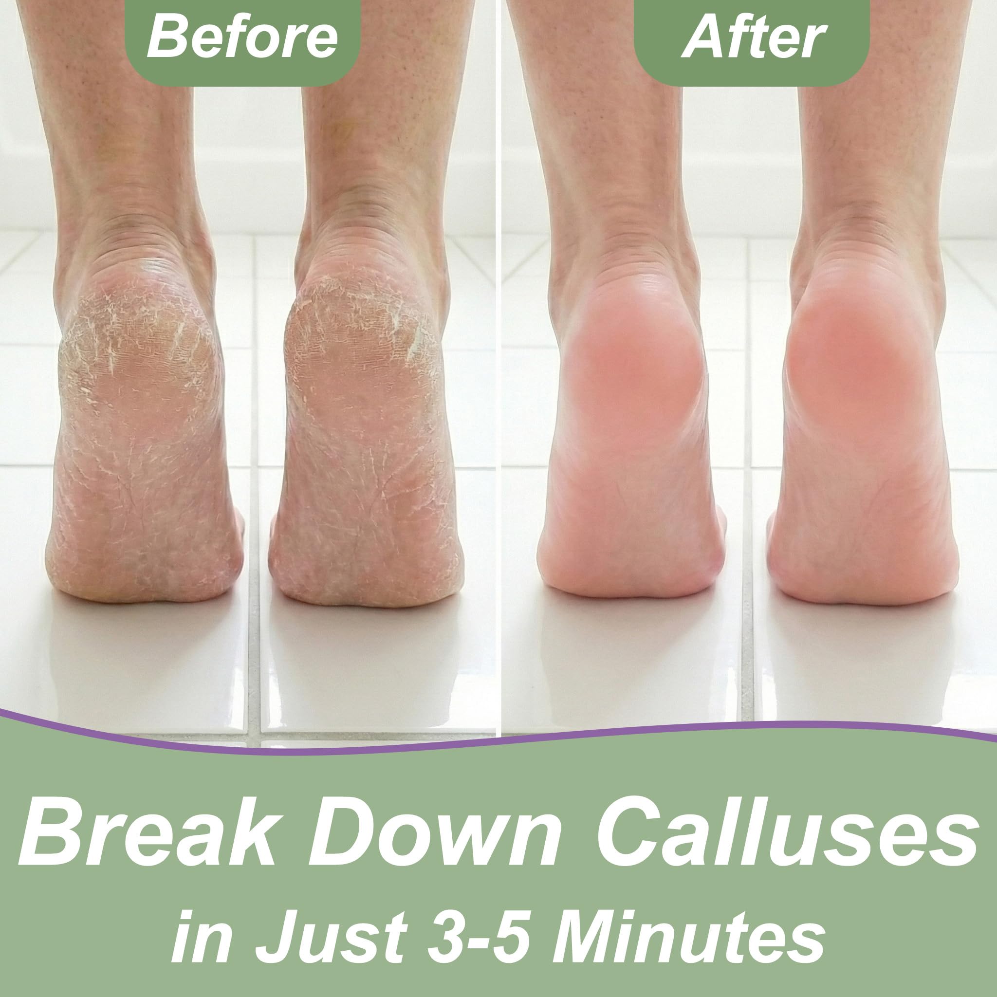 Step by step application of callus removal gel on heels