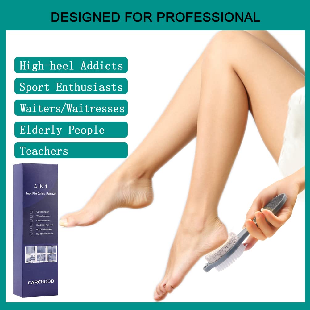 Fine grit sand paper side of the manual CAREHOOD foot scrubber for smoothing heels.