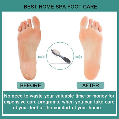 Ergonomic handle and convenient hanging loop design of the CAREHOOD multi-purpose foot scraper.