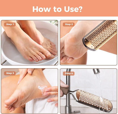 Easkep foot grater rasp for wet and dry feet