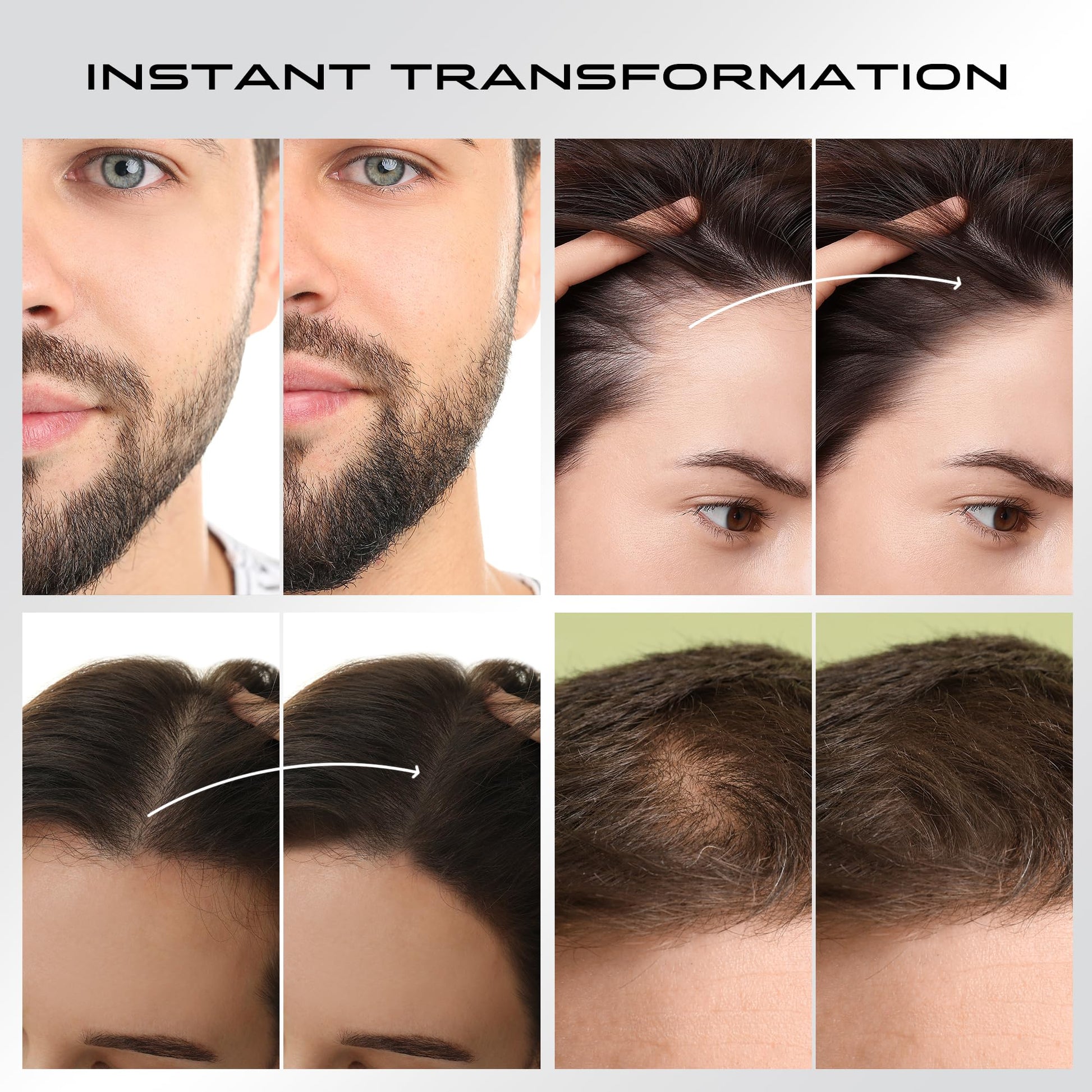 Premium imported hair thickening powder safe for men and women suffering from hair loss