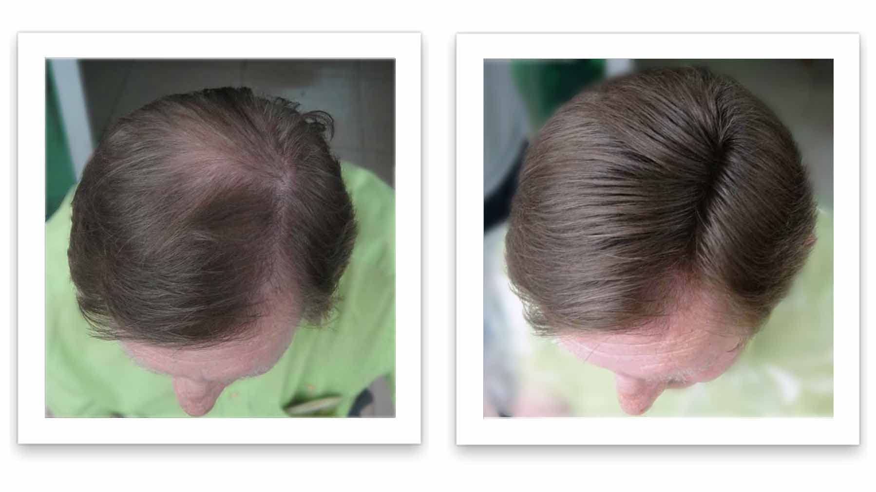 Caboki hair loss concealer travel size packaging side view