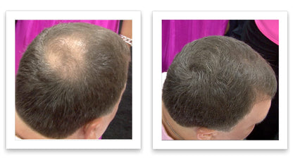 Caboki medium brown hair fibers before and after demonstration