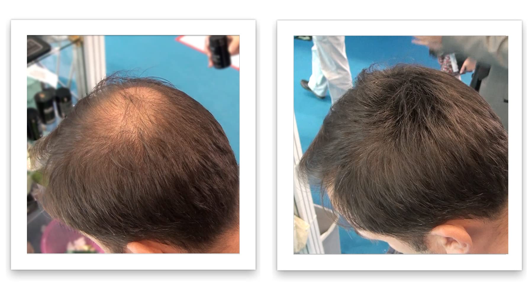 Caboki travel size hair concealer being applied to scalp