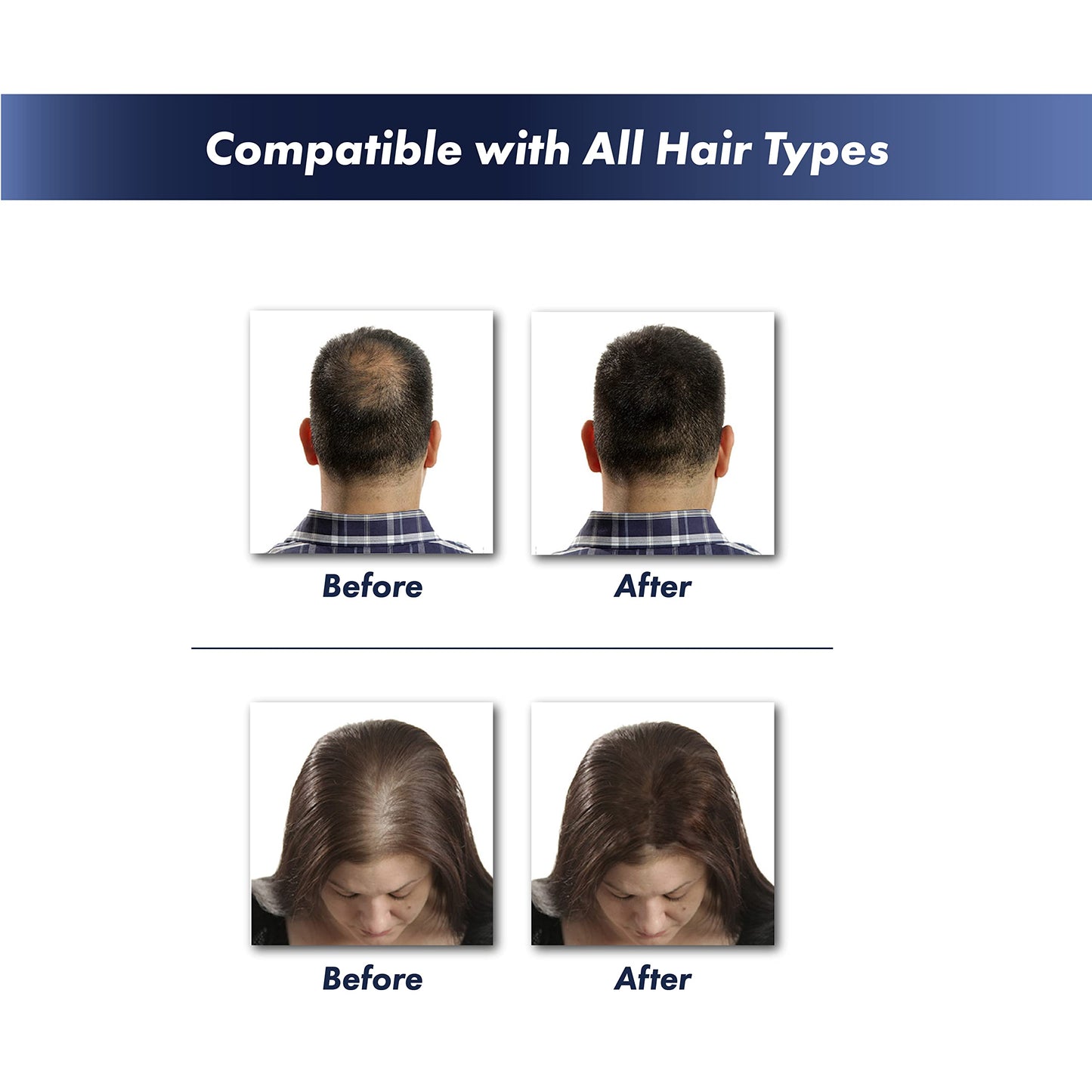 KeraFiber natural keratin hair thickener powder bottle angled perspective.