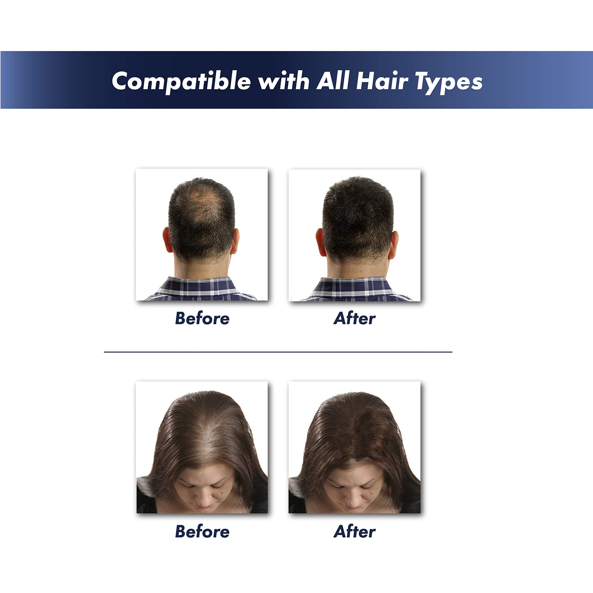 KeraFiber natural keratin hair thickener powder bottle angled perspective.