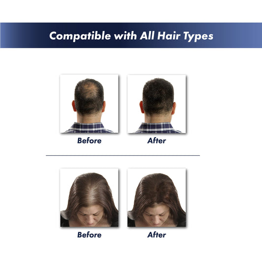 KeraFiber natural keratin hair thickener powder bottle angled perspective.