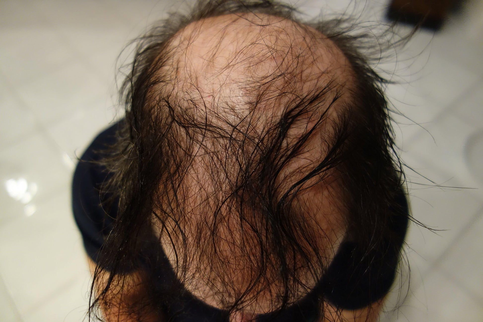 Demonstration of the medium salt and pepper hair building fibers texturing texture on a neutral background.
