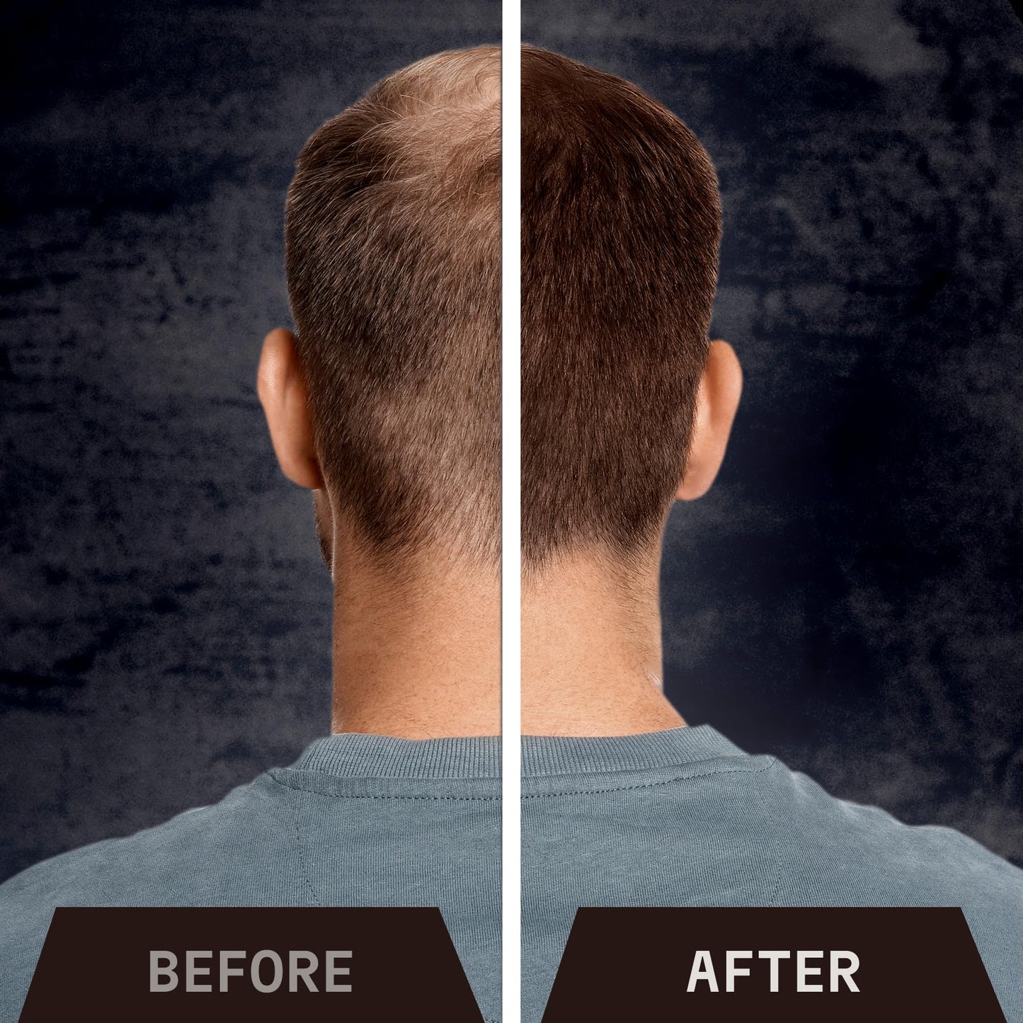 Product packaging angle showing the natural cotton and keratin fiber details for men and women.