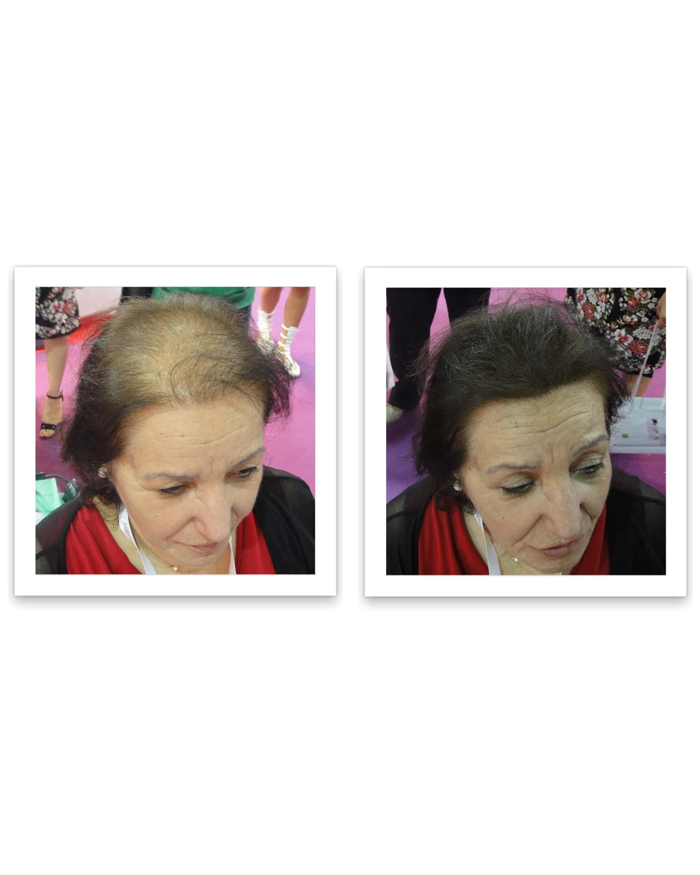 Side angle of Caboki hair thickening solution sixteen grams bottle for thinning hair