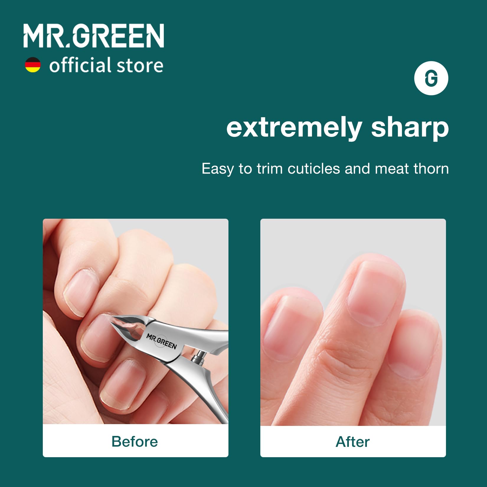 Premium medical grade stainless steel nail grooming set for precise home manicures.