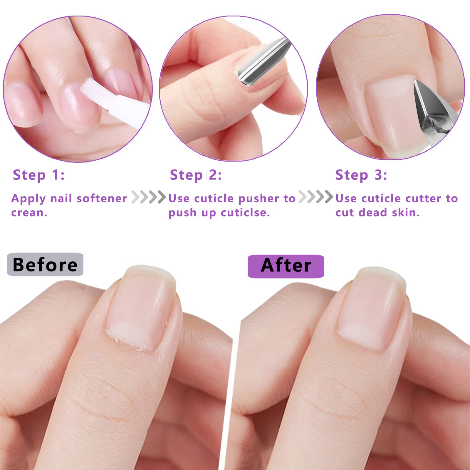Decute nail grooming kit with protective storage bag