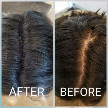 Black hair loss concealer powder fibers being applied to a thinning crown area.