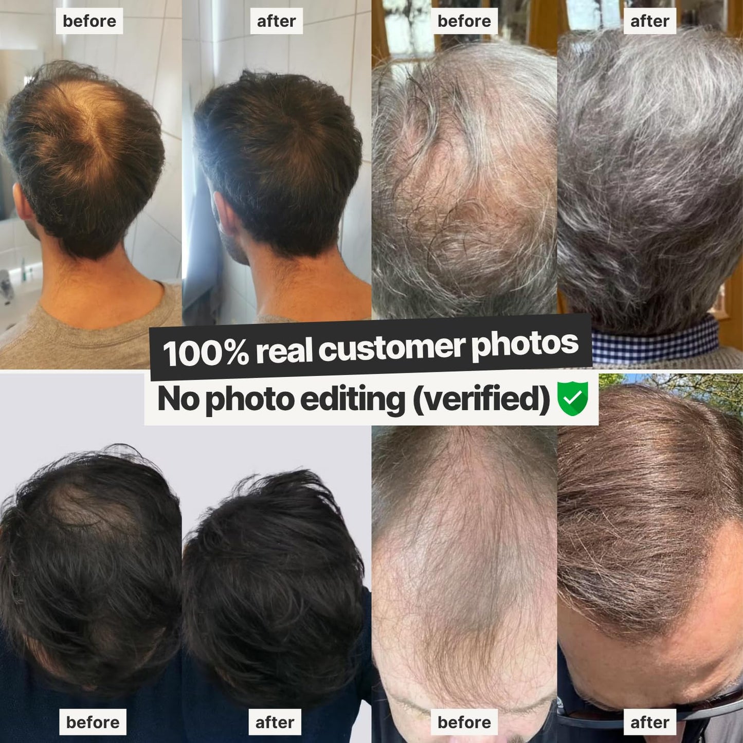 IMPERIO imported beauty hair loss concealer product display