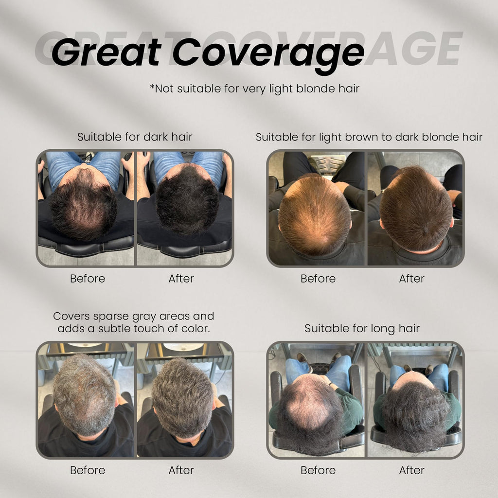 Demonstration of applying Batci hair concealer cream to thinning scalp areas