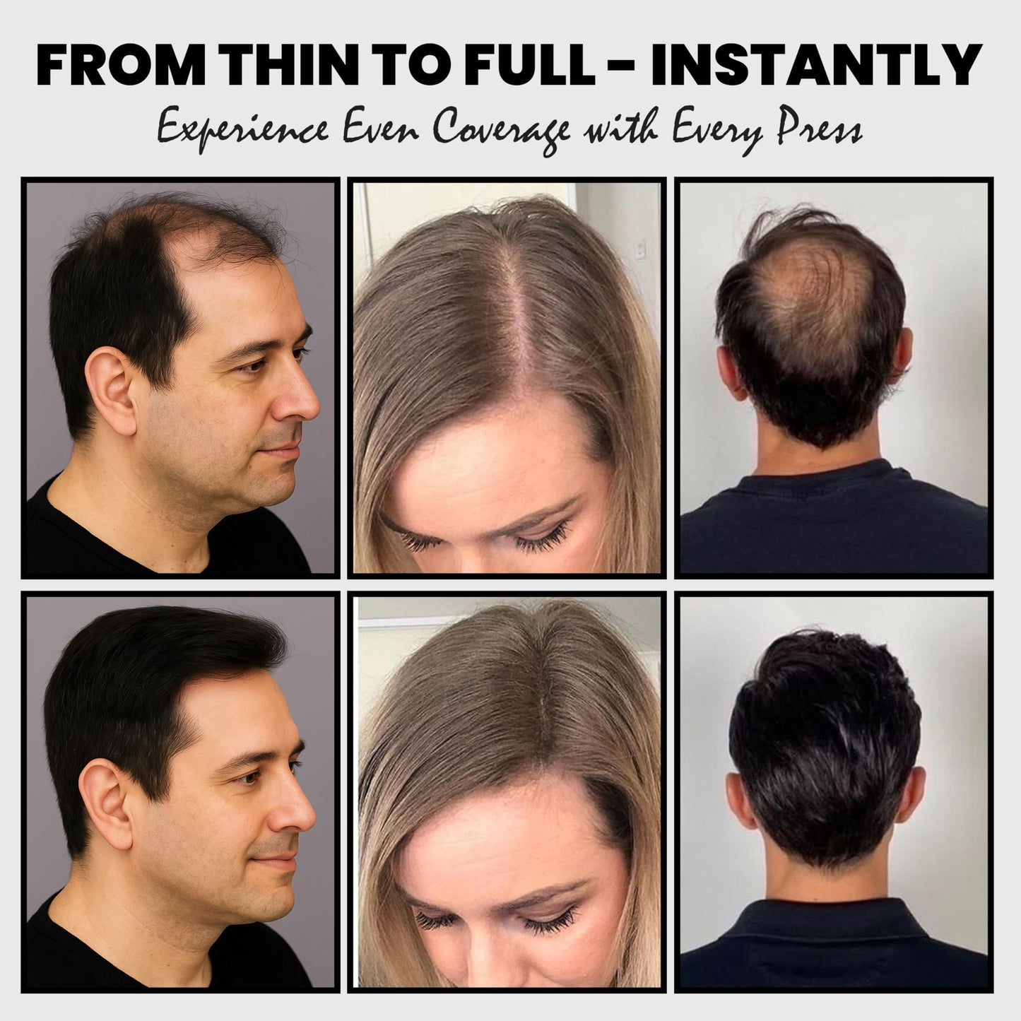 Adglamful hair coverage kit demonstrating the precise application on a front hairline.