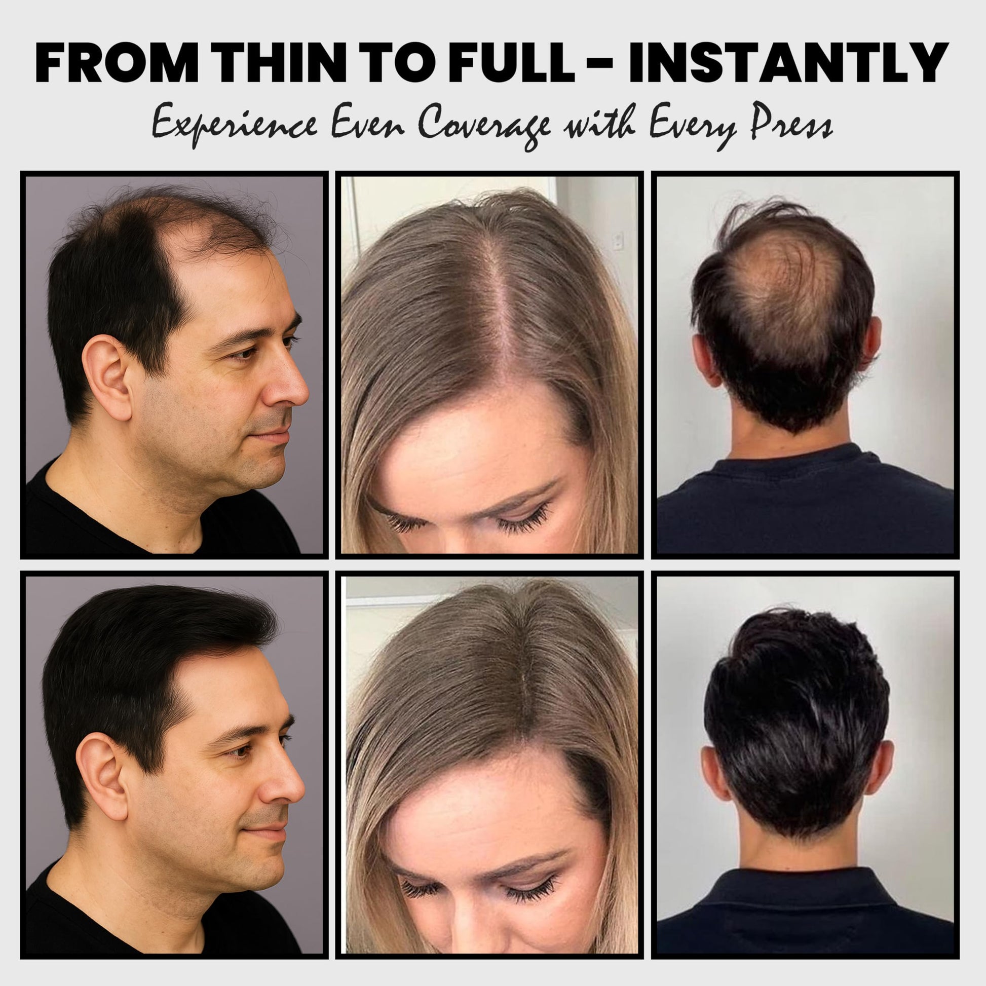 Adglamful hair coverage kit demonstrating the precise application on a front hairline.