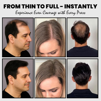 Adglamful hair coverage kit demonstrating the precise application on a front hairline.