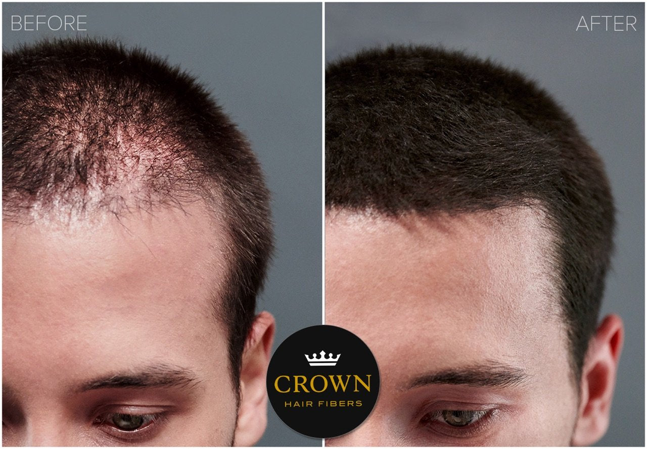 Close up view of dark brown cosmetic hair fibers texture for fine thinning scalp coverage