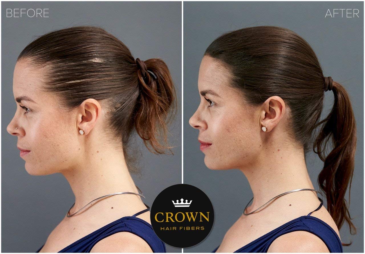 Crown Twenty1 hair loss solution container displayed next to its authentic import packaging box