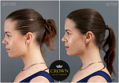 Crown Twenty1 hair loss solution container displayed next to its authentic import packaging box