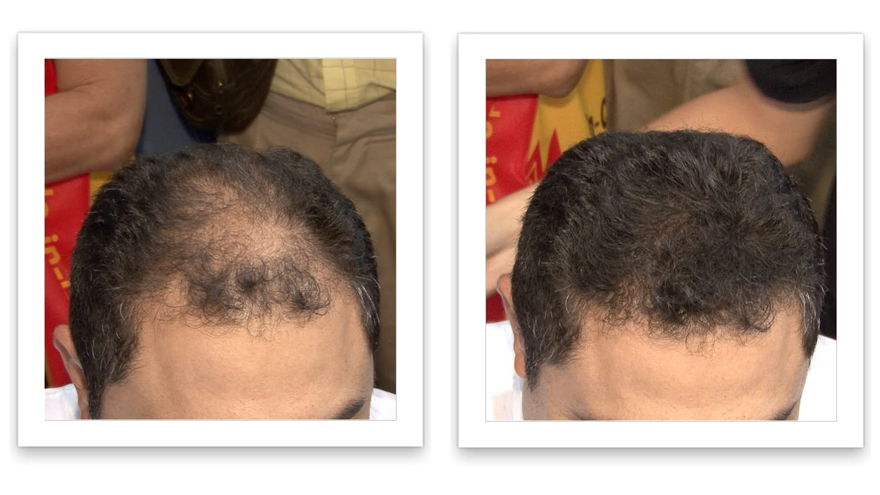 Caboki hair building fibers container showcasing the sweat and weather resistant seal