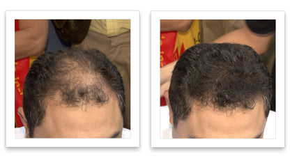 Caboki hair building fibers container showcasing the sweat and weather resistant seal